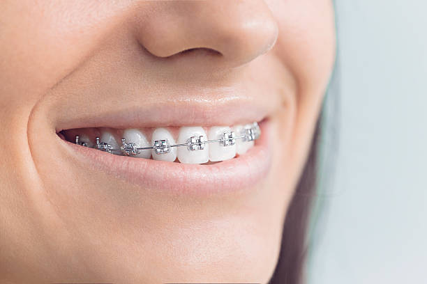 Why Choose Us for Your Dental Needs in Mclendon Chisholm, TX